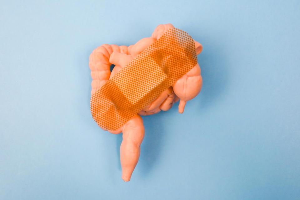 Lobbes - Le cancer colorectal chez les - de 50 ans