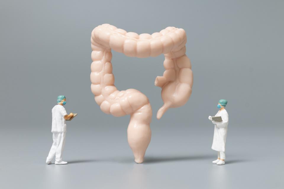 Le cancer colo-rectal métastatique 