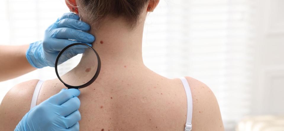 Le service de dermatologie de Jolimont