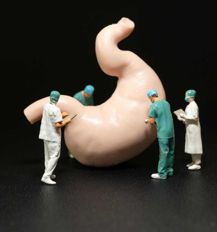 Chirurgie bariatrique : lancement de séances d'information trimestrielles sur le site Kennedy (Mons)